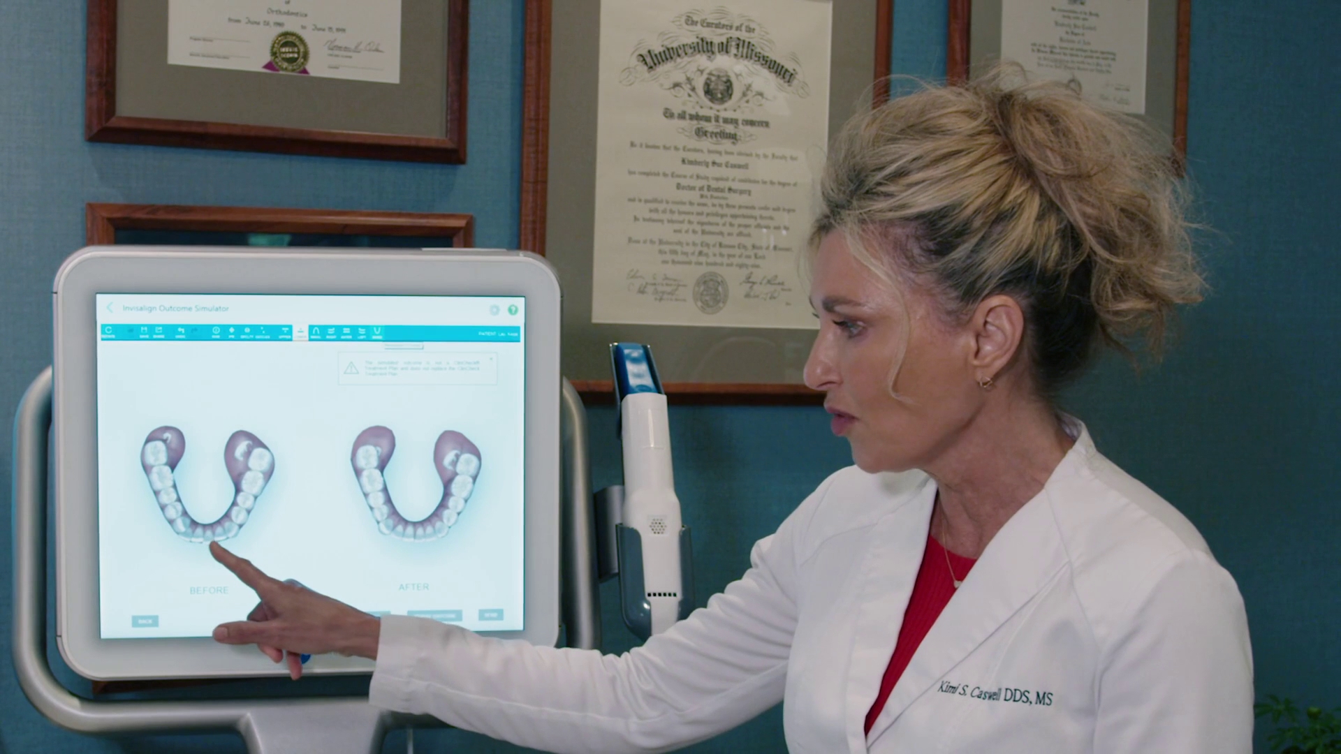 Dr. Caswell demonstrating Invisalign Outcome Simulator