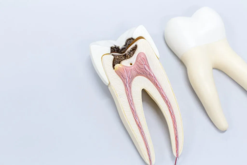 Root Canal in Sterling, VA | Discover 1 Endodontics for Pain-Free Dentistry