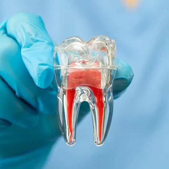 Saving Teeth With the Root Canal Sterling Trusts