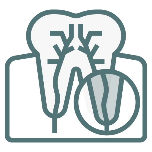Apicoectomy (Surgical Root Procedure)
