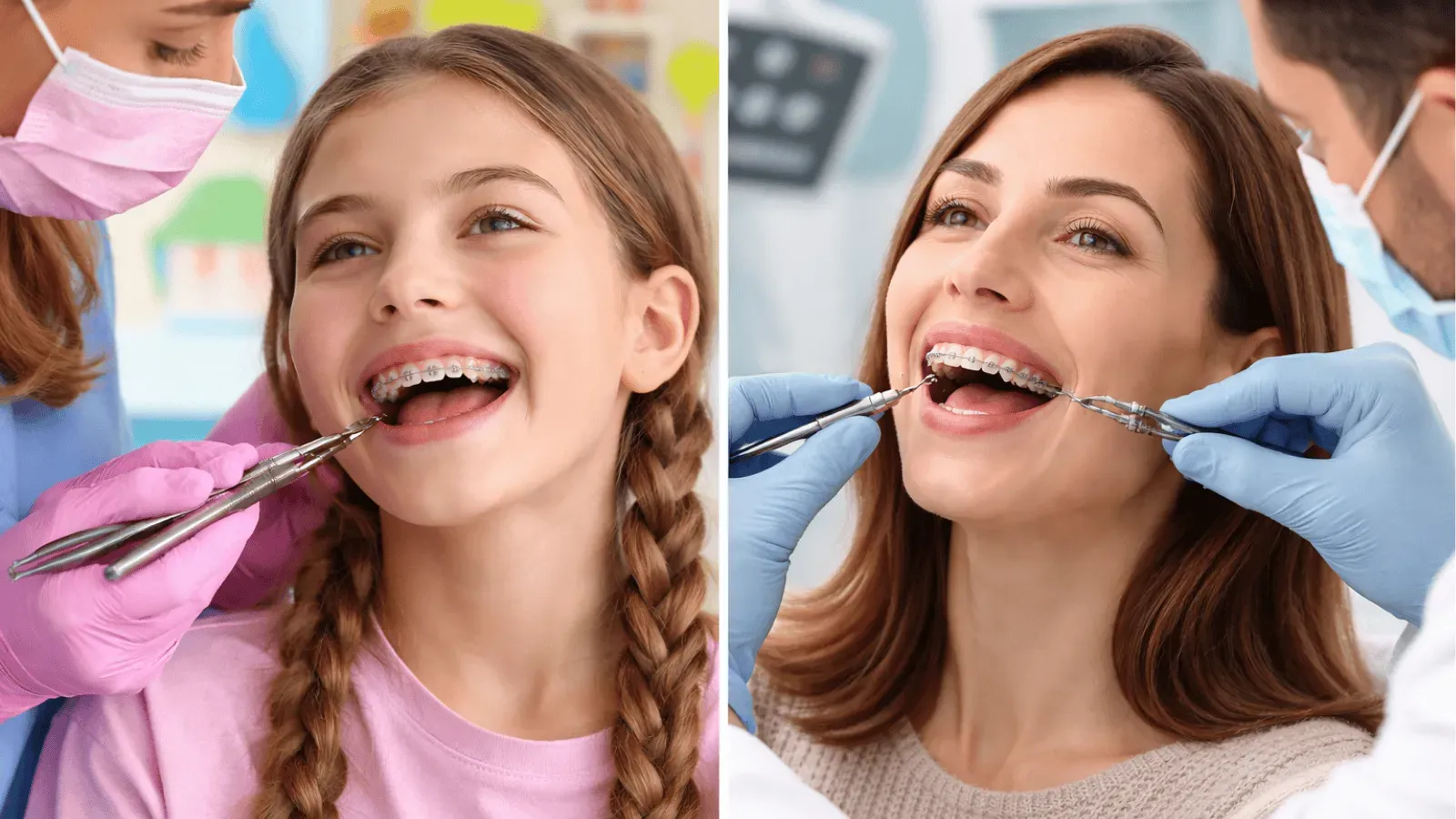 Braces for Kids vs. Braces for Adults