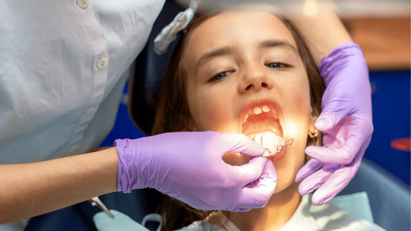 Best Age for Interceptive Orthodontic Treatment