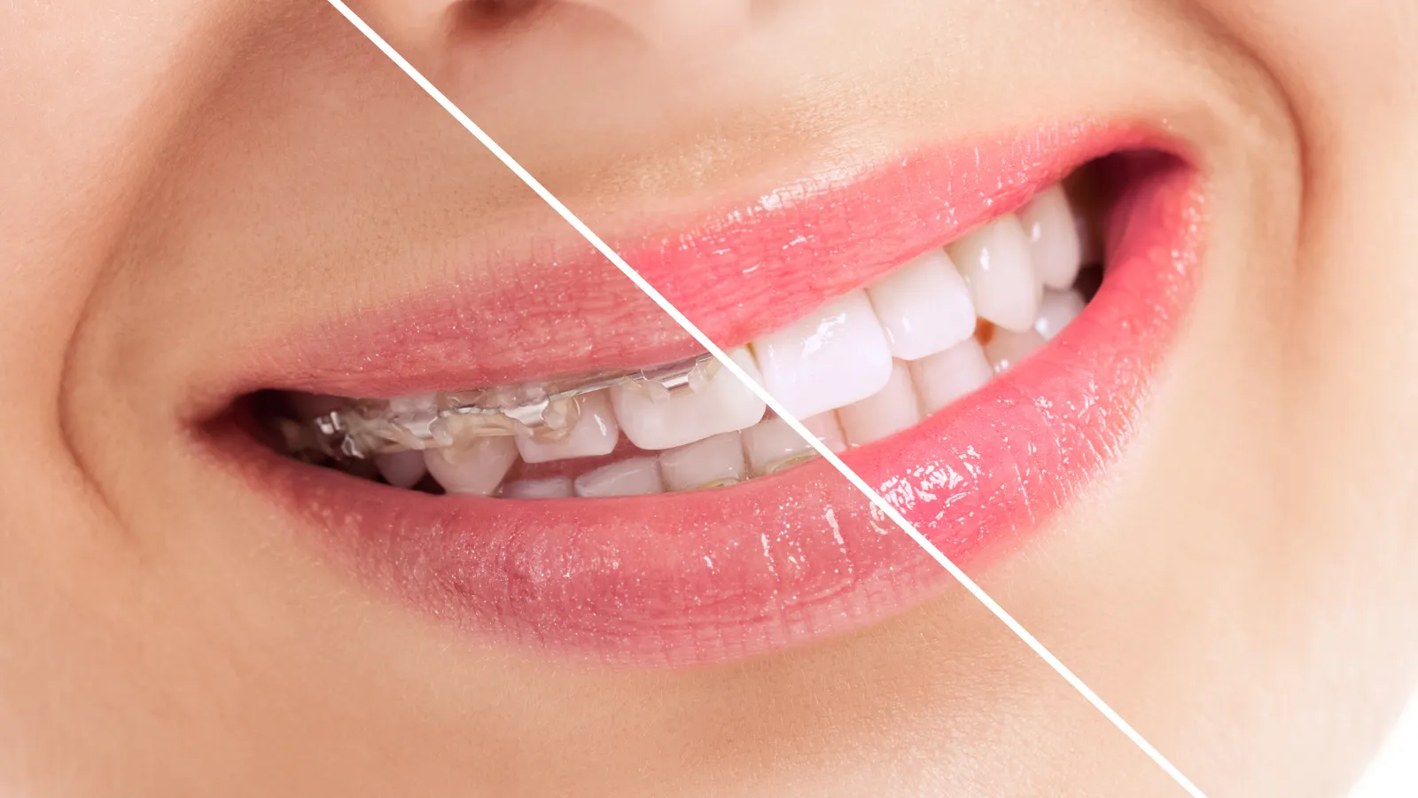 What is the difference between an orthodontist and a dentist?