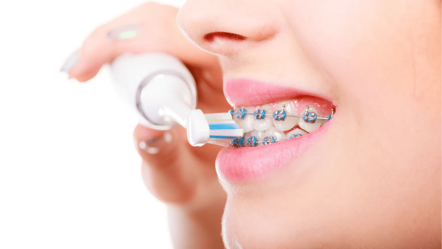 How to Keep Your Teeth Clean with Braces and Aligners