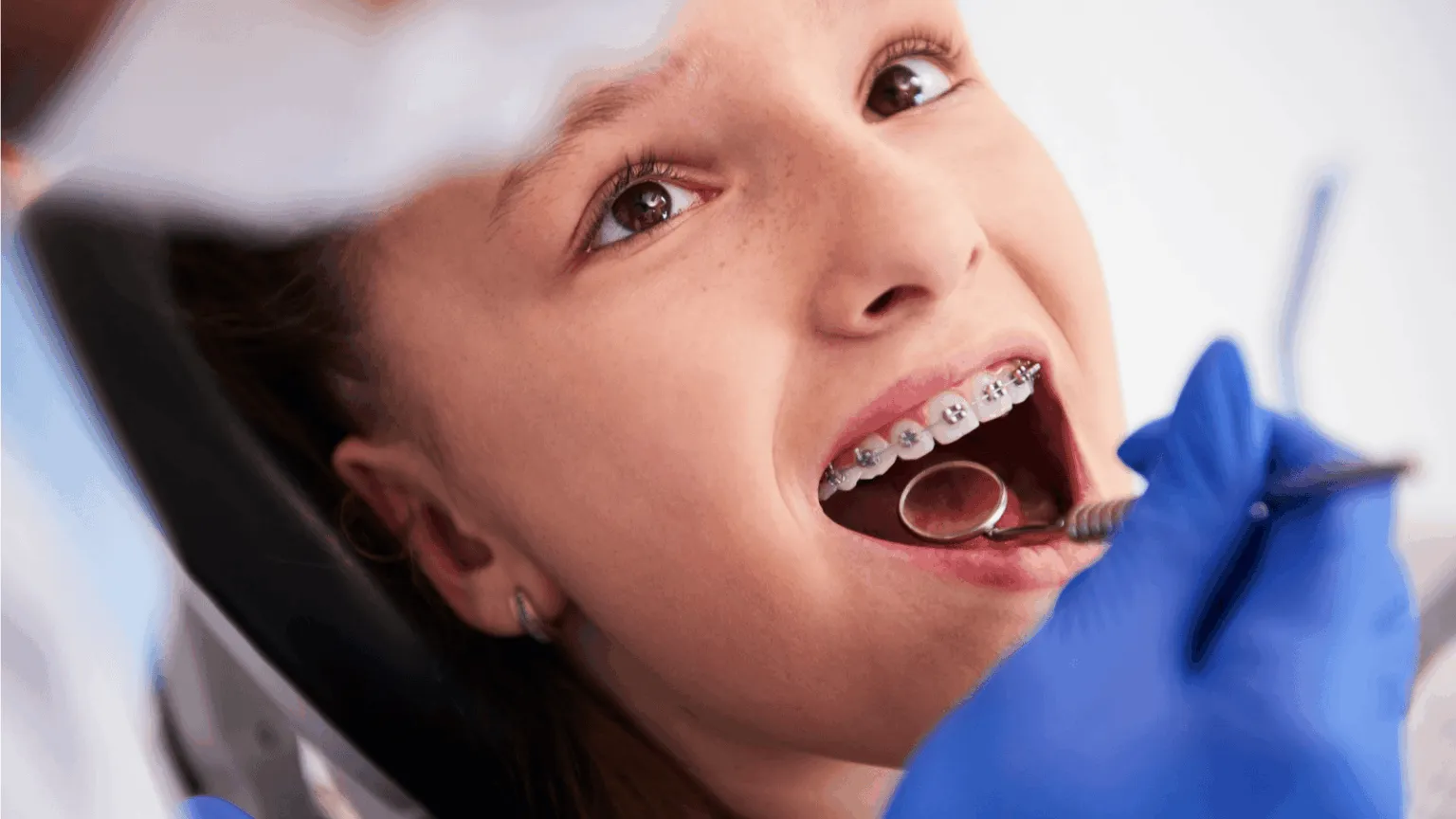 Braces Care Checklist: Do’s and Don’ts for Healthy Teeth