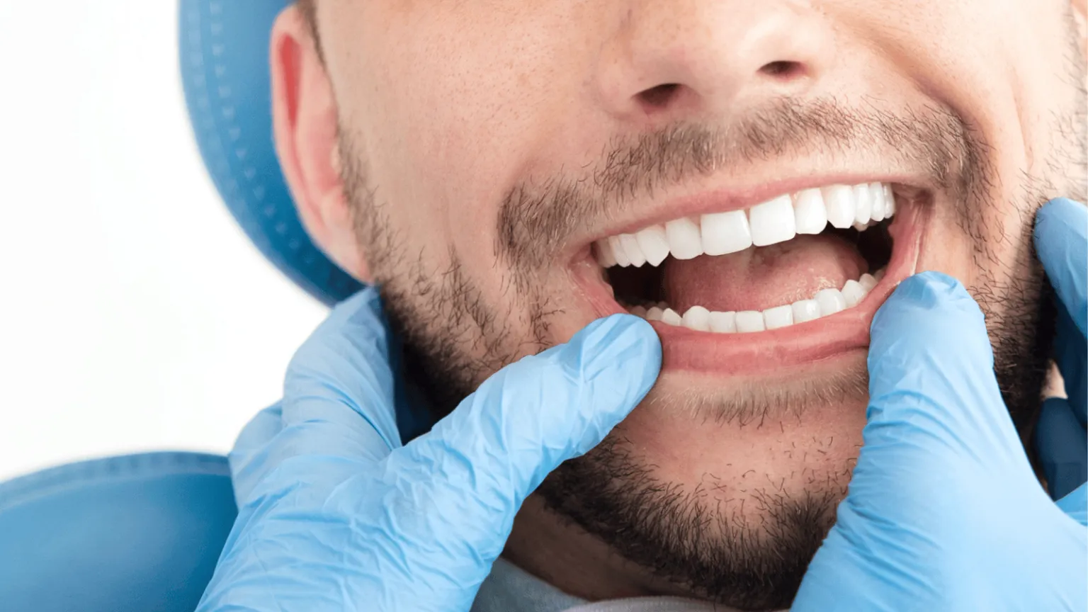 Why Orthodontic Care Isn’t Just About Straight Teeth