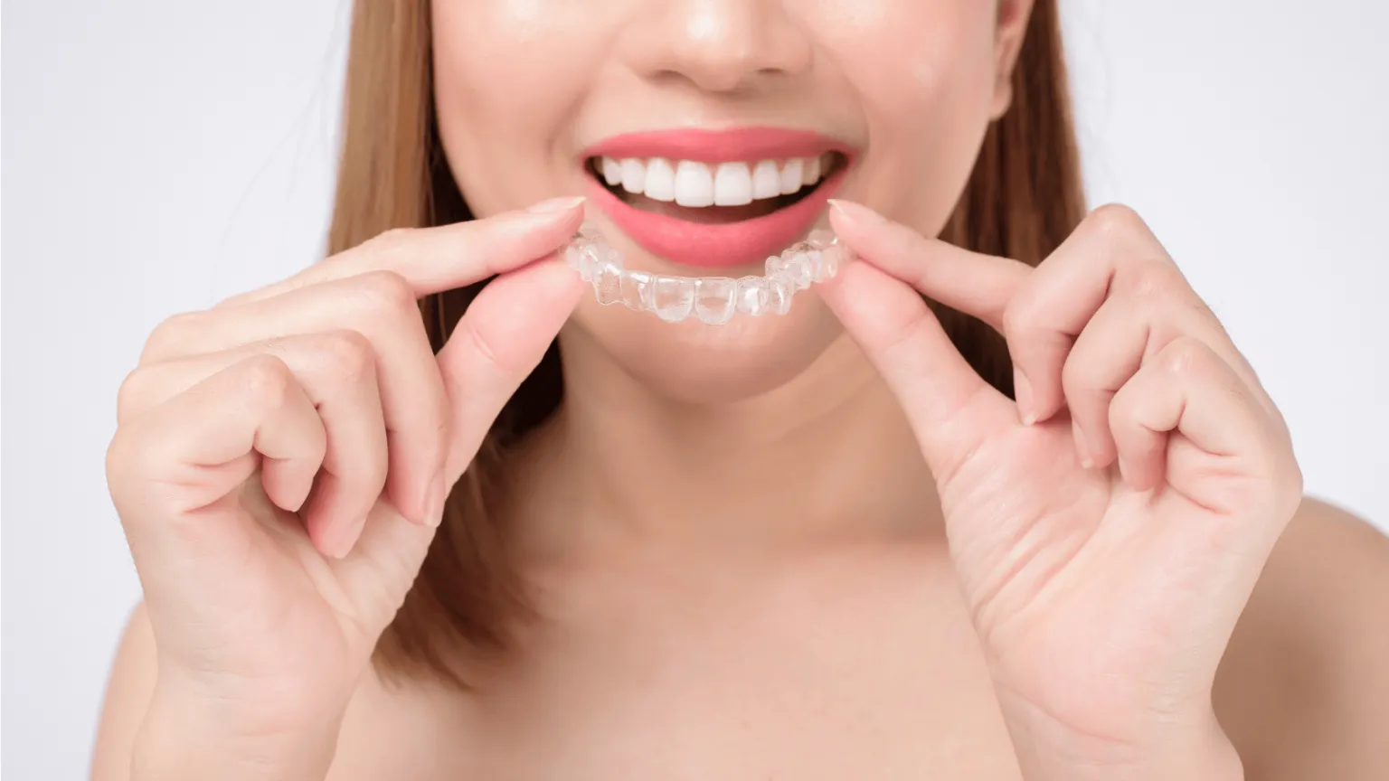 Invisalign vs Braces: Which Is Right for Your Lifestyle?