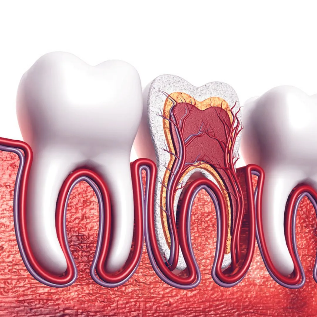 Why You Might Need a Root Canal and Not Even Know It