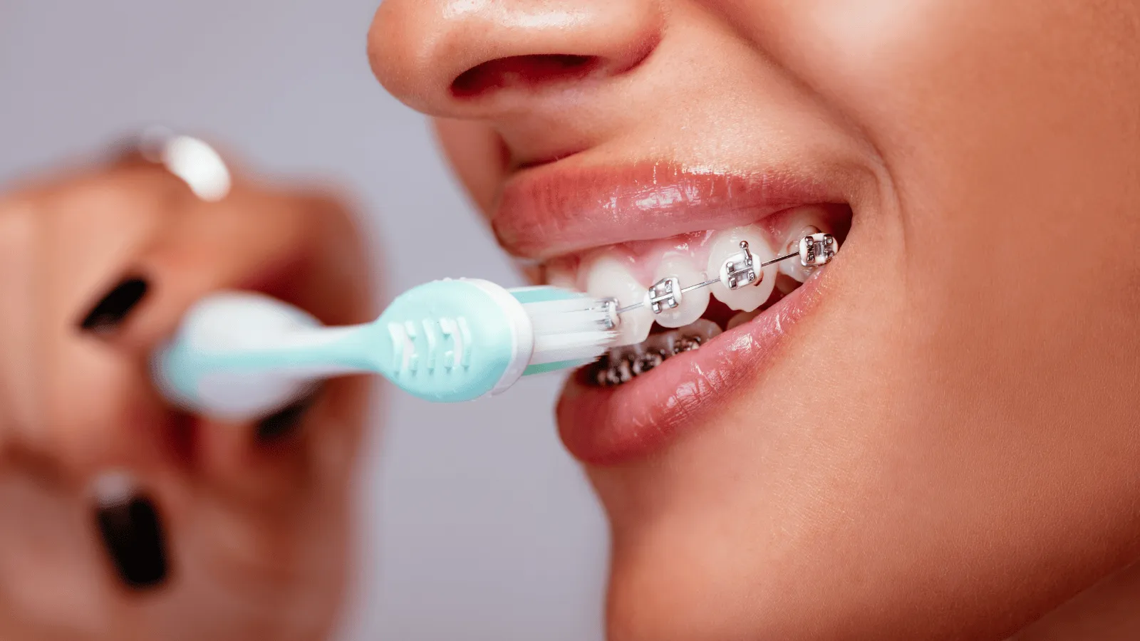 How to Care for Your Braces and Avoid Common Problems