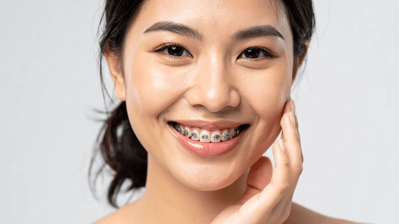 Does Wearing Braces Cause Tooth Decay?