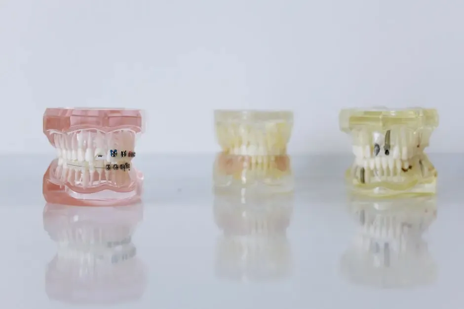 What Are LightForce Braces and How Do They Work?