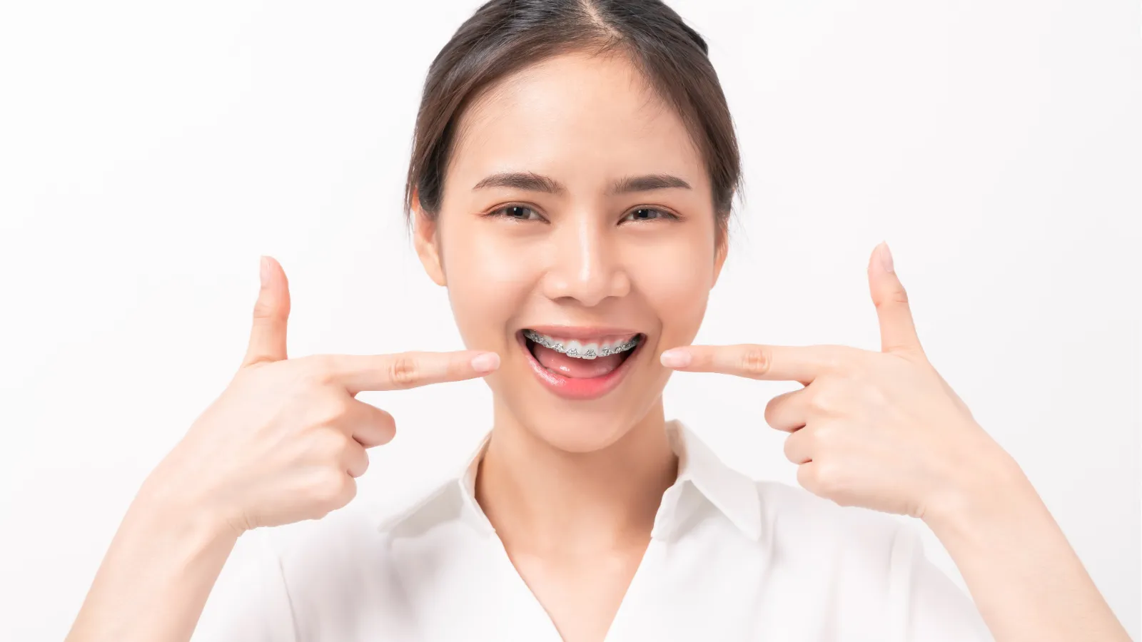 Are LightForce Braces Suitable for All Ages?