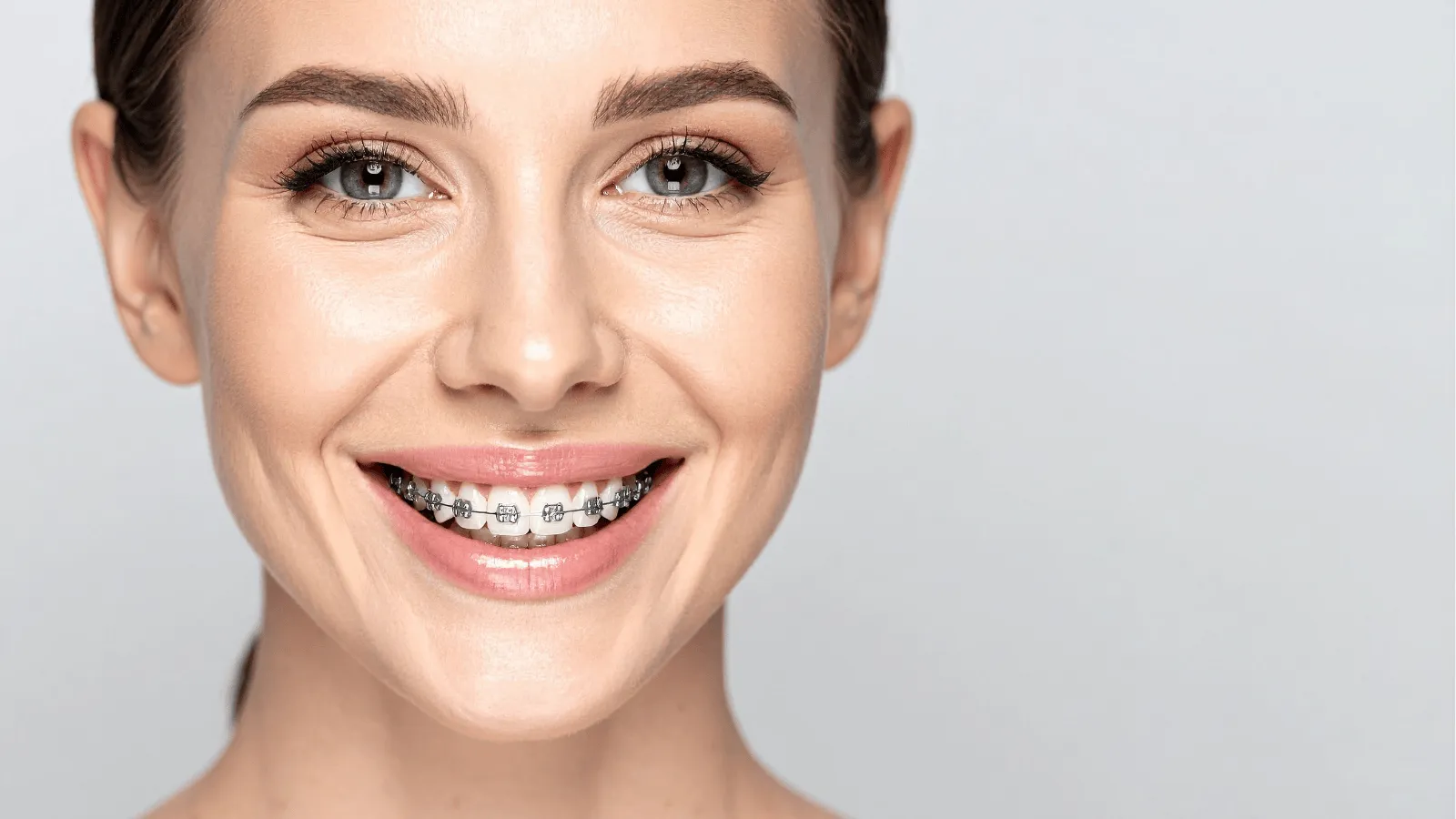 Can I Get Adult Braces If I Have Missing Teeth?