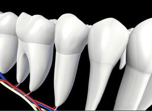 3D dental illustration showing a completed or final stage of root canal treatment with healthy white teeth and no visible instrument, depicting the post-procedure result against a black background.